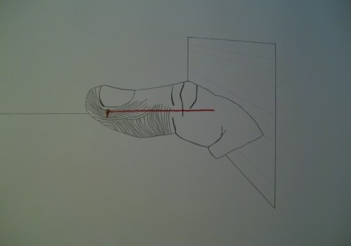 Injury_in_perspective_crop